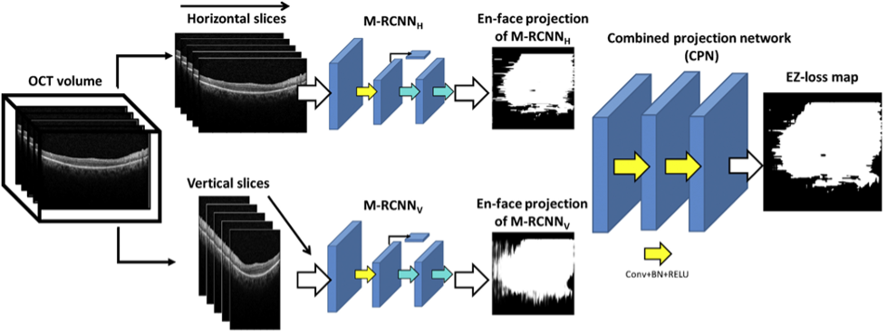 Decision Tree. First OCT volume -> horizontal slices -> M-RCnnH->En-face projection of M-RCNNH->Combined projection network->EZ loss map. Second: OCT volume-> veritcal slices-> M-RCNNv-> En-face projection of M-RCNNv->Conv+BN+RELU->EZ-loss map