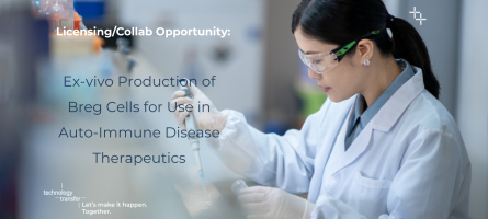 Woman in a lab. Licensing/collaboration opportunity: Ex-vivo Production of Breg Cells for Use in Auto-Immune Disease Therapeutics.
