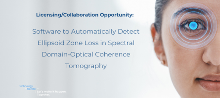 Licensing/collaboration opportunity: software to automatically detect Ellipsoid Zone Loss in SPectral Domain-Optical Coherence Tomography