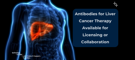 Antibodies for Liver Cancer Therapy Available for Licensing or Collaboration